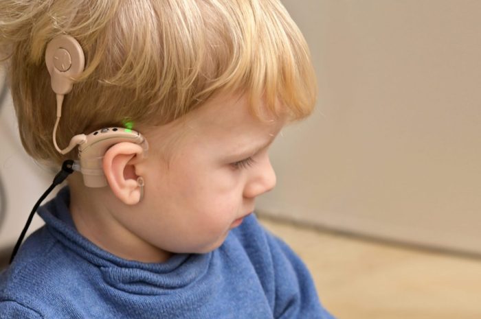 Cochlear implants hearing implant boy hipoacusia diferencias